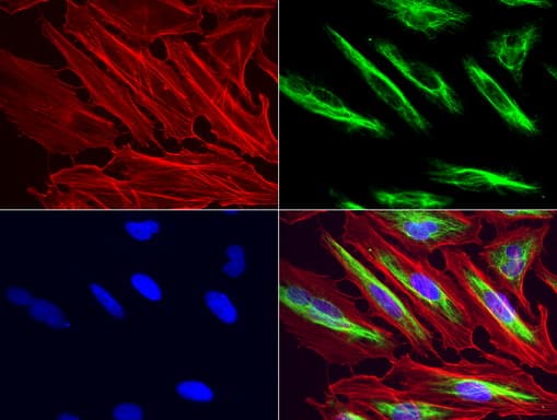 Vimentin Antibody (clone UMAB160, Carrier-free)