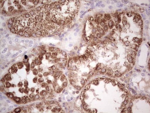 RSPO3 Antibody (aa22-272, clone OTI3A9)