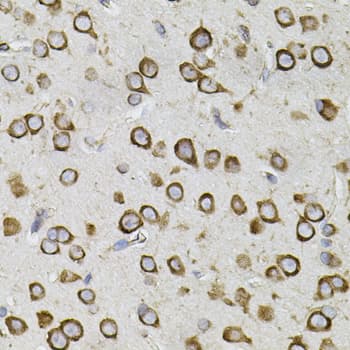 CEP164 Antibody