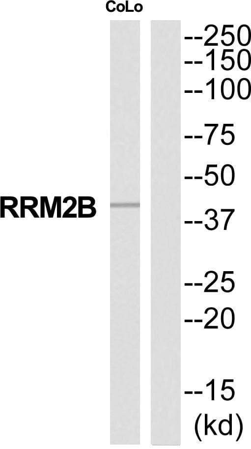 RRM2B / P53R2 Antibody