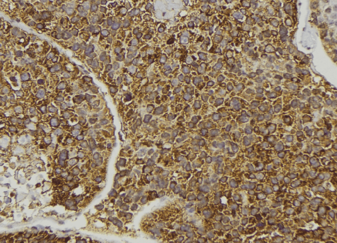 Polyclonal Rabbit anti-Human EPHB6 / EPH Receptor B6 Antibody (IHC, IF, WB)