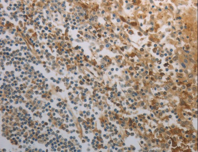 Polyclonal Rabbit anti-Human INHA / Inhibin Alpha Antibody (IHC)