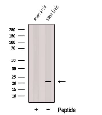 CPLX3 Antibody