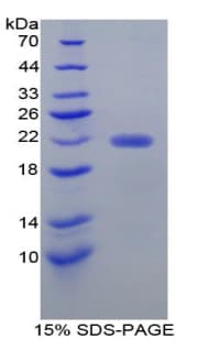 Mouse FCN2 / Ficolin-2 Protein (Recombinant His-T7)