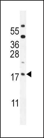 IHC-plus™ ORMDL3 Antibody (aa53-81)