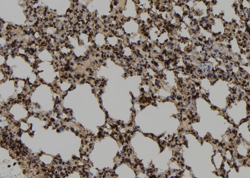 Polyclonal Rabbit anti-Human DNAJB14 Antibody (IHC, IF, WB)