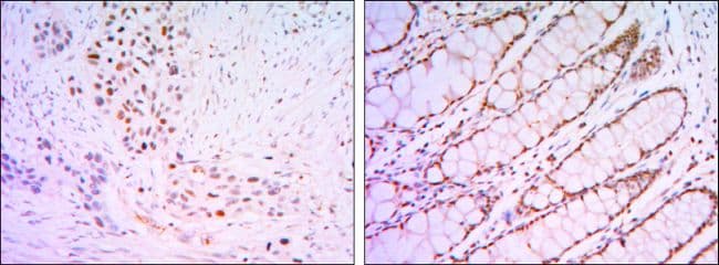 Monoclonal Mouse anti-Human KLF4 Antibody (clone 100000, Amino Acid: 2-470, IHC, WB)