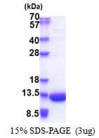 Human LSM5 Protein (Recombinant His)