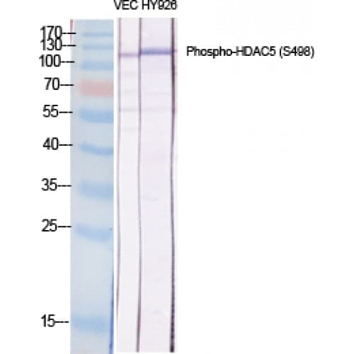 HDAC5 Antibody (440-520 aa)