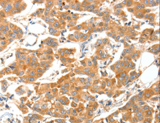 Polyclonal Rabbit anti-Human ADAMTS18 Antibody (IHC)