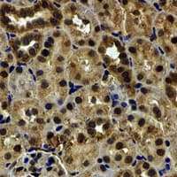 LETMD1 / HCCR1 Antibody