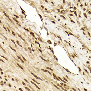 PHAP1 / ANP32A Antibody