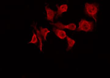 CERKL Antibody