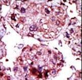 HK1 / Hexokinase 1 Antibody (aa78-108)