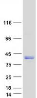 Human PRPH2 Protein (Recombinant Myc-DDK (Flag))