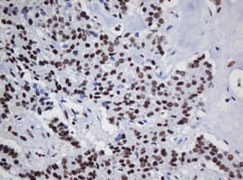 DCPS Antibody (clone OTI1E6)