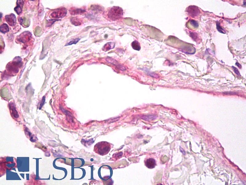 IHC-plus™ VEGFA / VEGF Antibody