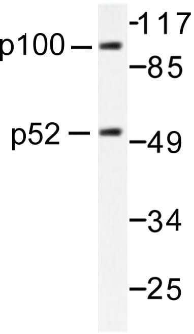 NFKB1 / NF-Kappa-B Antibody (Ala901)