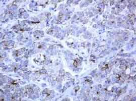 ABCB1 / MDR1 / P Glycoprotein Antibody (aa995-1280, clone 6H2, Carrier-free)