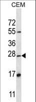 NSG1 Antibody (aa31-60)