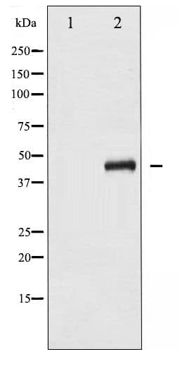 Polyclonal Rabbit anti-Human MAP2K4 / MKK4 Antibody (phospho-Ser80, IHC, WB)