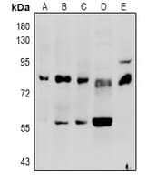F2 / Prothrombin / Thrombin Antibody