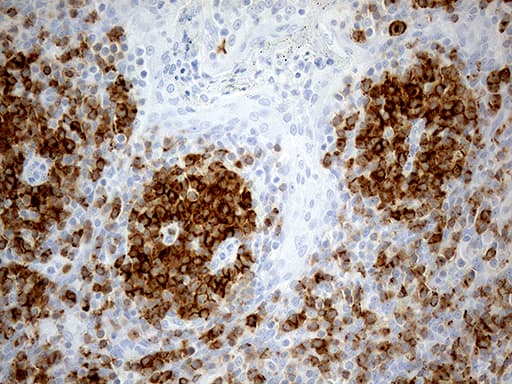 LY9 / CD229 Antibody (aa48-454, clone OTI2H4)