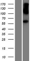 AHCYL1 / DCAL Protein (Over-Expression Lysate Myc-DDK (Flag))