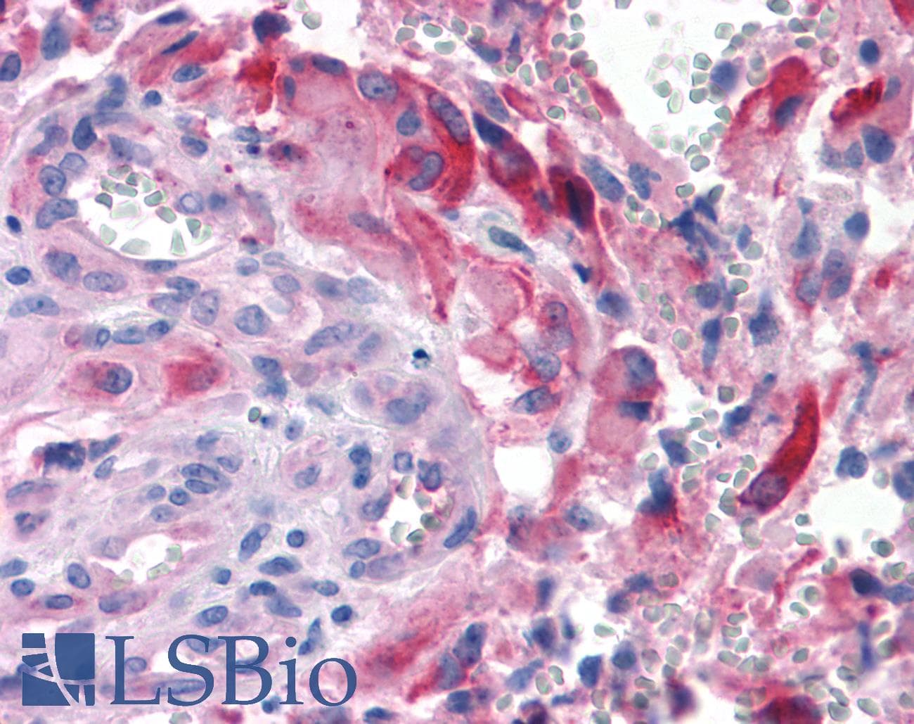 PathPlus™ Polyclonal Rabbit anti-Human APLNR/ Apelin Receptor / APJ Antibody (Extracellular Domain, IHC)