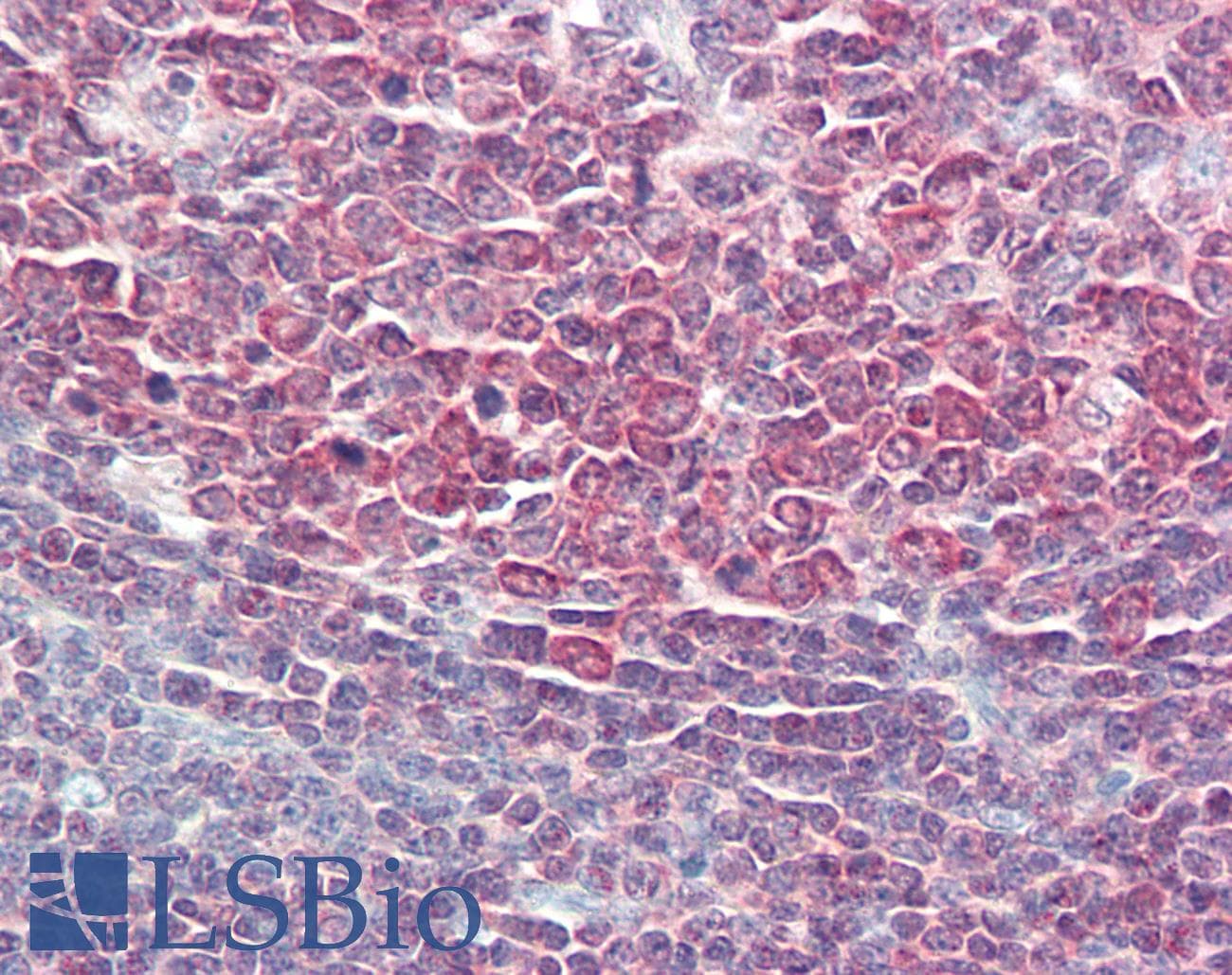 IHC-plus™ PPP1R10 / PNUTS Antibody (aa350-400)