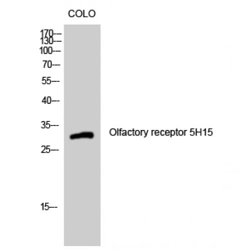 OR5H15 Antibody (210-290 aa, C-terminal)
