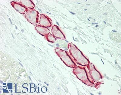 IHC-plus™ Polyclonal Rabbit anti-Human CTDSP1 / SCP1 Antibody (aa22-71, IHC, WB)