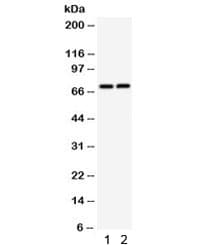 TNFRSF1B / TNFR2 Antibody
