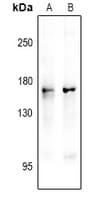 Polyclonal Rabbit anti-Human NOS1 / nNOS Antibody (WB)