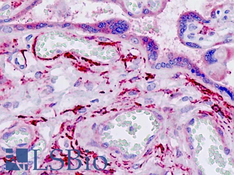 IHC-plus™ Polyclonal Rabbit anti-Human ARHGEF2 / GEF-H1 Antibody (aa383-432, IHC, WB)