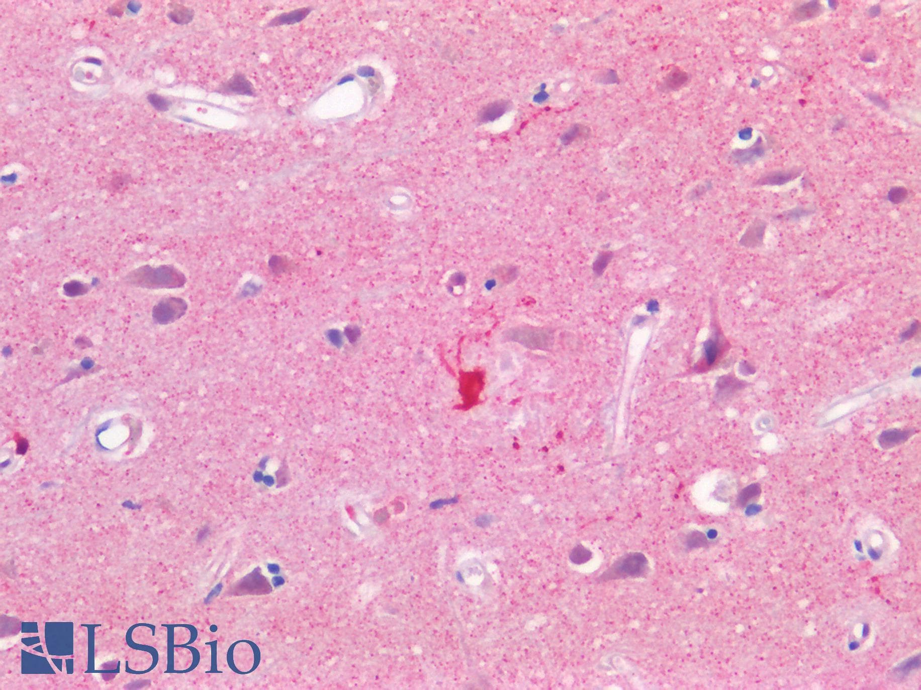 IHC-plus™ Monoclonal Mouse anti-Bovine CAPN1 / Calpain 1 Antibody (clone 15C10, IHC, WB)