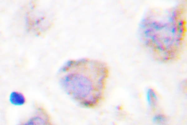 PTK2B / PYK2 Antibody (Arg875)