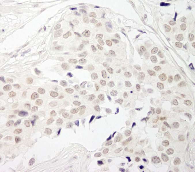 PPP1CB Antibody (aa280-C-term)