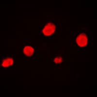 Polyclonal Rabbit anti-Human EZH1 / ENX-2 Antibody (Internal, IHC, IF, WB)