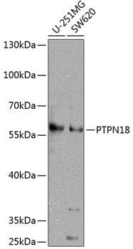 Polyclonal Rabbit anti-Human PTPN18 Antibody (WB)