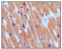 NPPB / BNP Antibody (Glu-Pro-Leu-Gln-Glu-Ser-Pro-Arg-Pro-Thr-Gly-Val-Trp-Cys, clone 3A6F7C7)