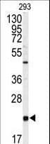 PEBP1 / RKIP Antibody (aa137-167)
