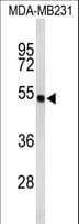 FLAD1 / FADS Antibody (aa551-580)