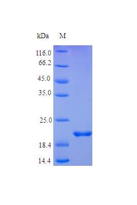 Human TNFRSF1A / TNFR1 Protein (Recombinant)