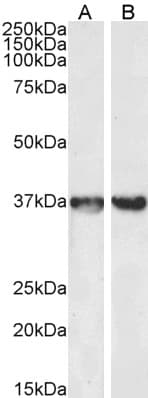 IHC-plus™ Polyclonal Goat anti-Human GAPDH Antibody (aa279-290, IHC, IF, WB)