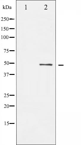 Polyclonal Rabbit anti-Human ATF2 Antibody (IHC, IF, WB)
