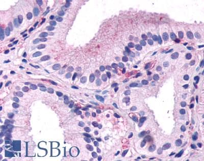 IHC-plus™ CCKAR / CCK1R Antibody (C-Terminus)