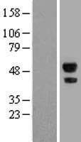 ABHD2 Protein (Over-Expression Lysate Myc-DDK (Flag))