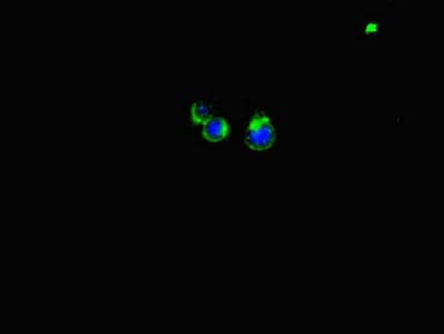 Polyclonal Rabbit anti-Human LATS1 Antibody (IHC, IF)