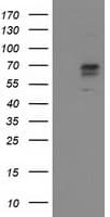 ALDH3A2 Antibody (clone OTI1H4)